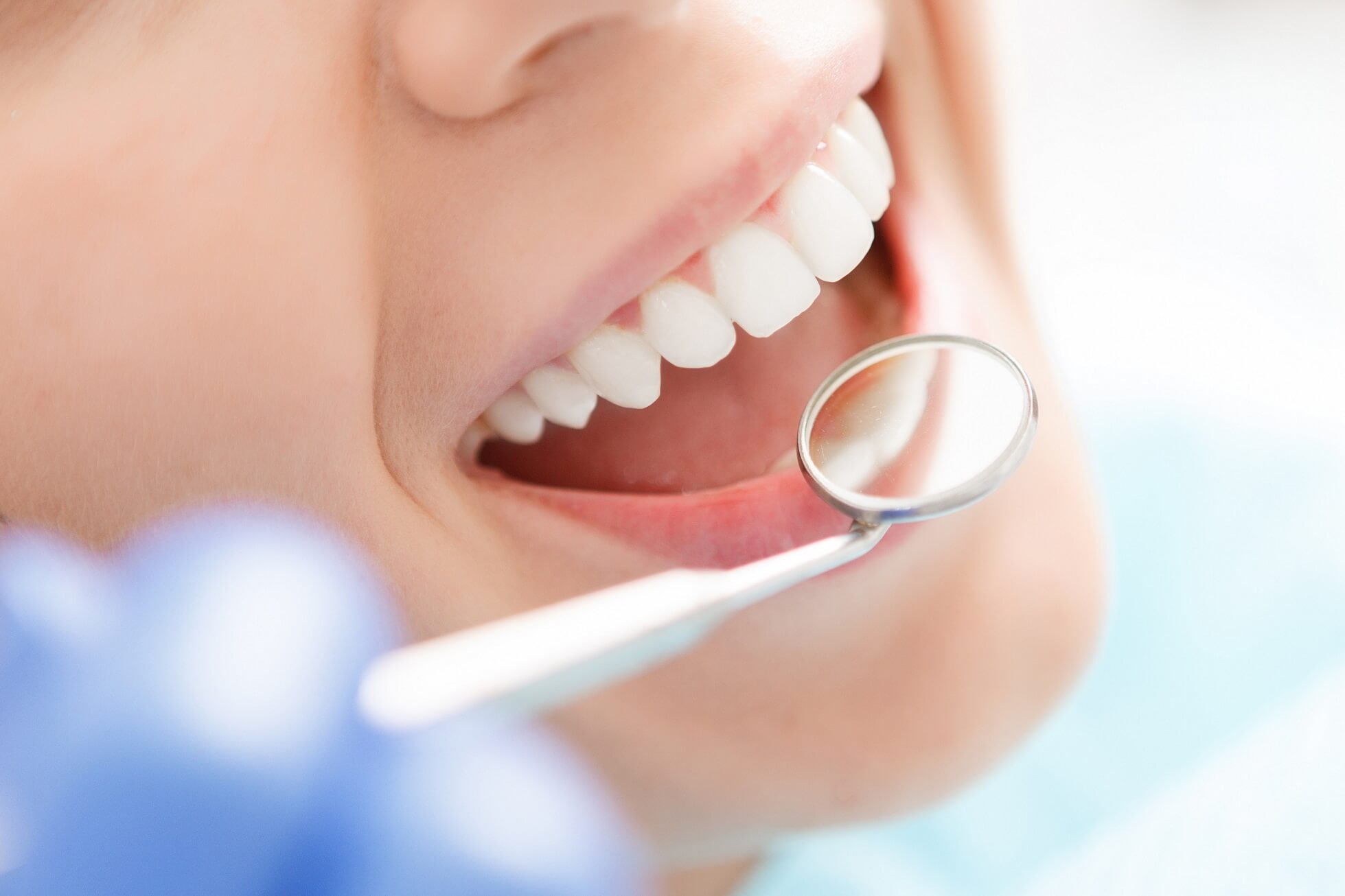 General Dentistry at Neua Dental - Preventive and Restorative Care Services in Singapore